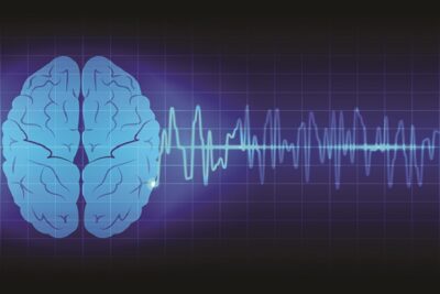 Best doctors for epilepsy treatment in Nagpur