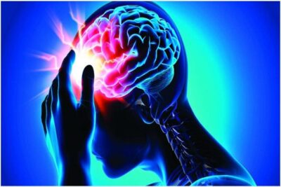 Best Doctors For Stroke Treatment In Nagpur