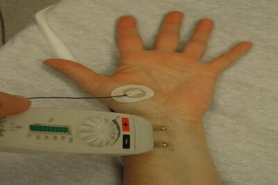 Nerve conduction study and electromyography