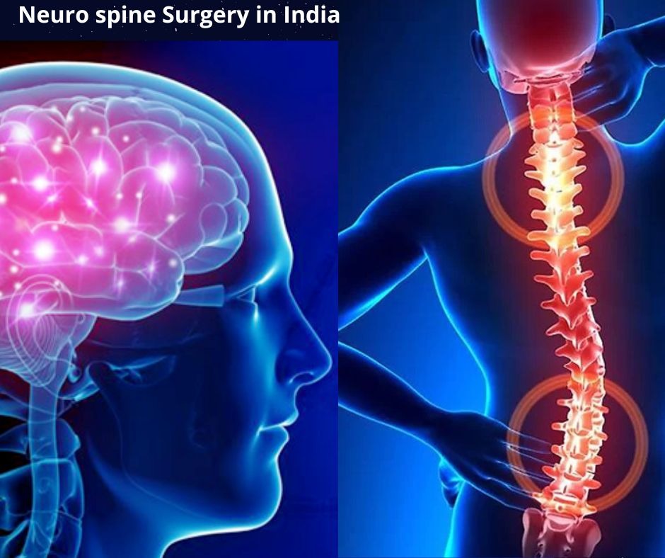 The Role of Neurosurgery in Spine Treatment and Prevention: Dr. Sameer Paltewar,    Among the Best Spine Surgeons in Nagpur